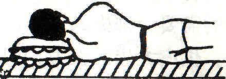 图 一　　高枕致颈椎侧弯