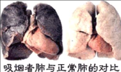 两肺对比.jpg