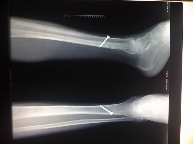 调整大小 IMG_0033.jpg